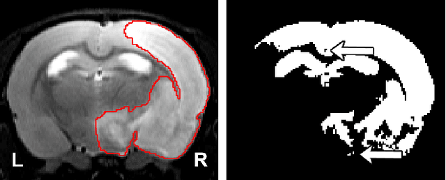 Figure 1 for RatLesNetv2: A Fully Convolutional Network for Rodent Brain Lesion Segmentation