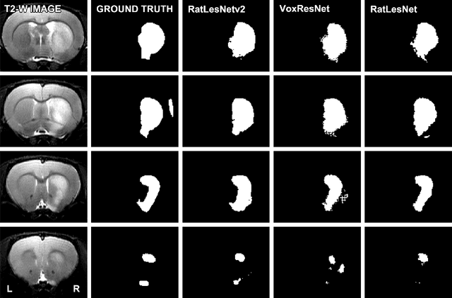 Figure 3 for RatLesNetv2: A Fully Convolutional Network for Rodent Brain Lesion Segmentation