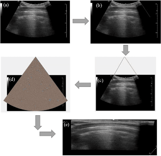 Figure 2 for An Approach Towards Physics Informed Lung Ultrasound Image Scoring Neural Network for Diagnostic Assistance in COVID-19