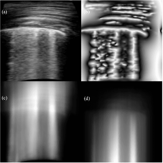 Figure 3 for An Approach Towards Physics Informed Lung Ultrasound Image Scoring Neural Network for Diagnostic Assistance in COVID-19