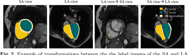 Figure 3 for Right Ventricular Segmentation from Short- and Long-Axis MRIs via Information Transition