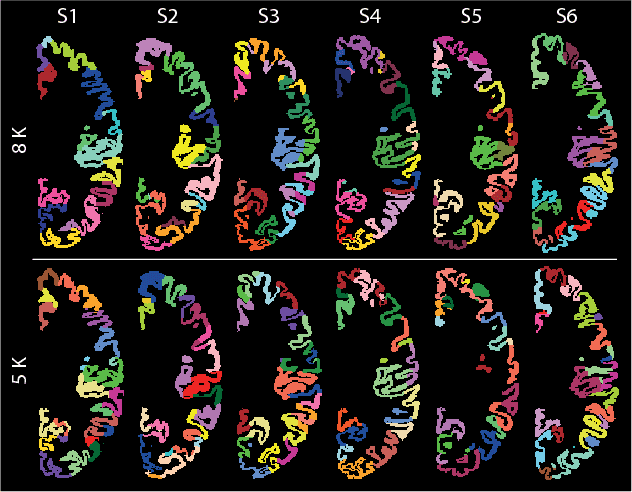 Figure 1 for Characterization of Brain Cortical Morphology Using Localized Topology-Encoding Graphs