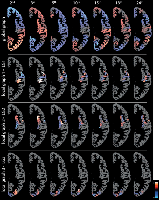 Figure 3 for Characterization of Brain Cortical Morphology Using Localized Topology-Encoding Graphs