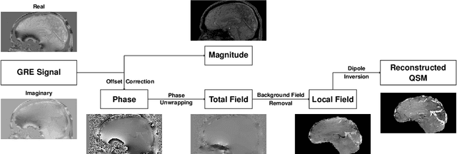 Figure 1 for Whole Brain Susceptibility Mapping Using Harmonic Incompatibility Removal