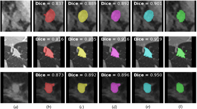 Figure 4 for Weakly Supervised Lesion Co-segmentation on CT Scans