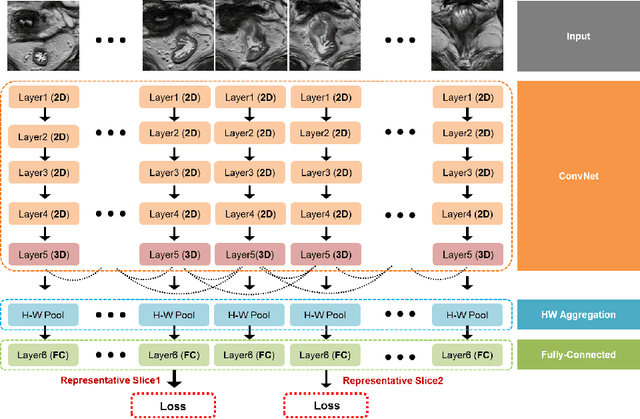 Figure 3 for Moving from 2D to 3D: volumetric medical image classification for rectal cancer staging