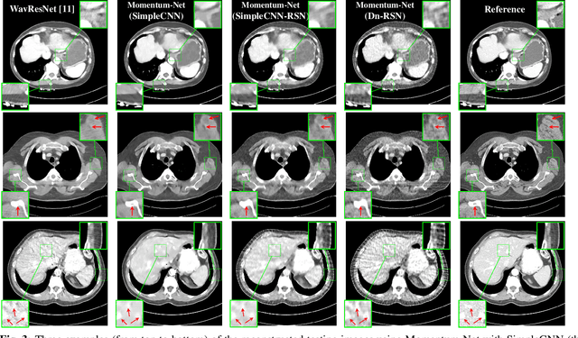 Figure 4 for Momentum-Net for Low-Dose CT Image Reconstruction
