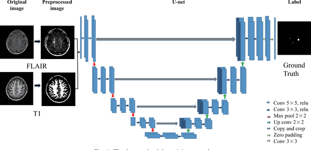 Figure 1 for A post-processing method to improve the white matter hyperintensity segmentation accuracy for randomly-initialized U-net