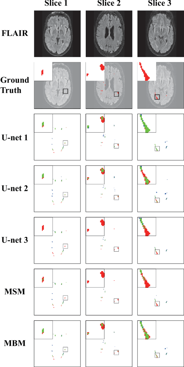 Figure 3 for A post-processing method to improve the white matter hyperintensity segmentation accuracy for randomly-initialized U-net