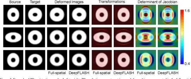 Figure 4 for DeepFLASH: An Efficient Network for Learning-based Medical Image Registration