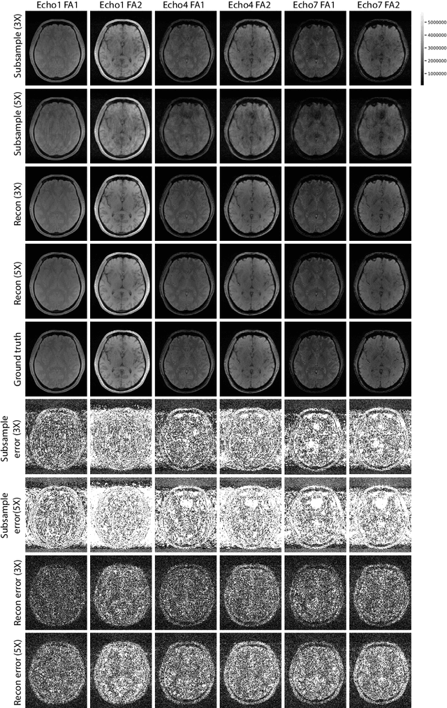 Figure 3 for Accelerating 3D MULTIPLEX MRI Reconstruction with Deep Learning