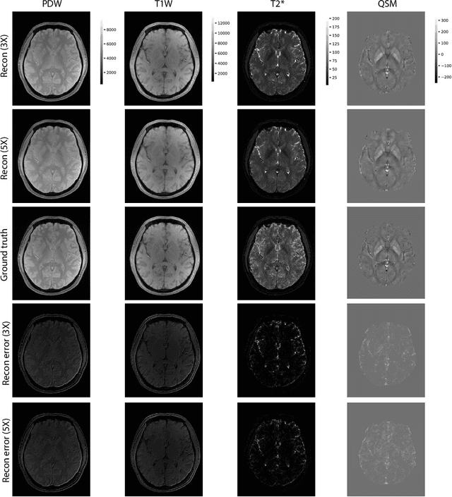 Figure 4 for Accelerating 3D MULTIPLEX MRI Reconstruction with Deep Learning