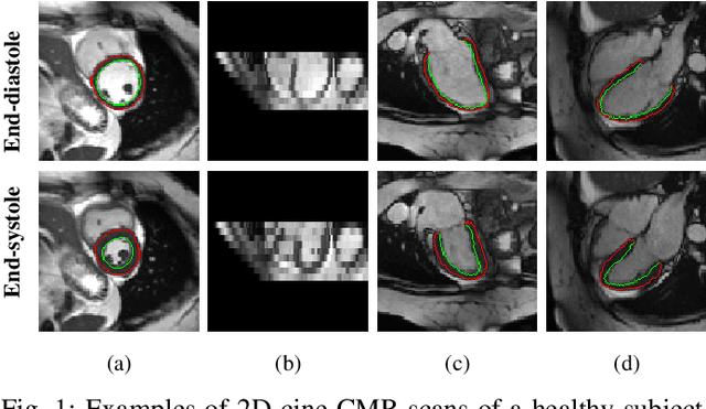 Figure 1 for MulViMotion: Shape-aware 3D Myocardial Motion Tracking from Multi-View Cardiac MRI