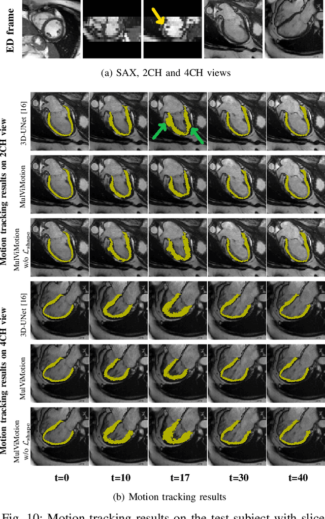 Figure 2 for MulViMotion: Shape-aware 3D Myocardial Motion Tracking from Multi-View Cardiac MRI