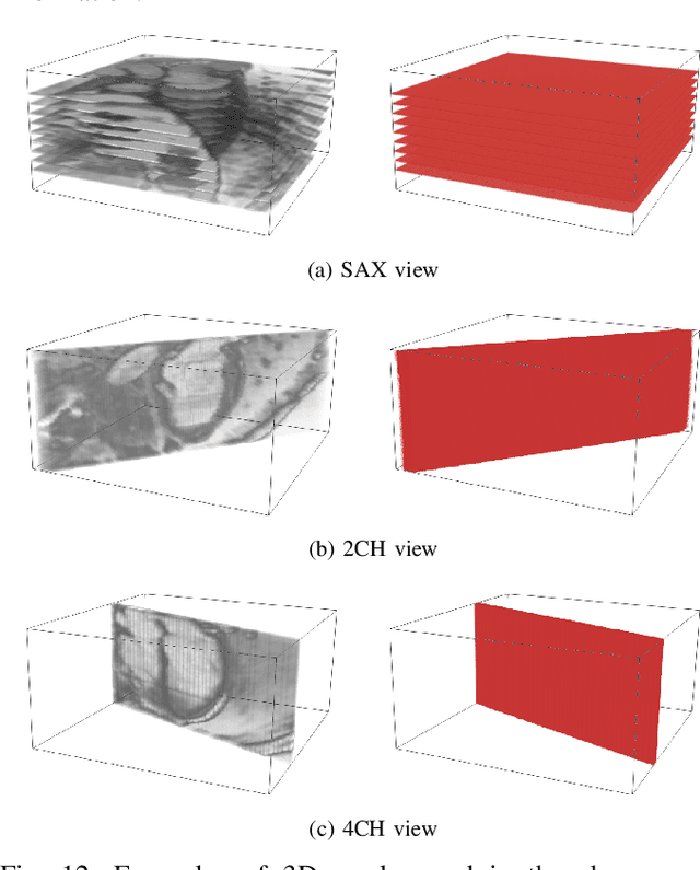 Figure 4 for MulViMotion: Shape-aware 3D Myocardial Motion Tracking from Multi-View Cardiac MRI
