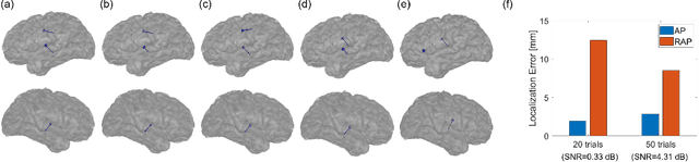 Figure 2 for Brain Source Localization by Alternating Projection