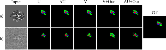 Figure 3 for TBraTS: Trusted Brain Tumor Segmentation
