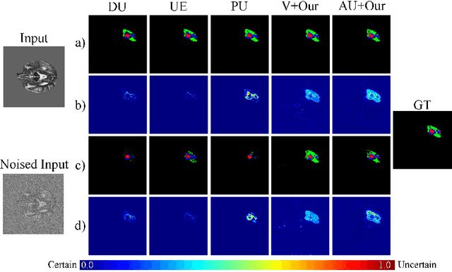 Figure 4 for TBraTS: Trusted Brain Tumor Segmentation