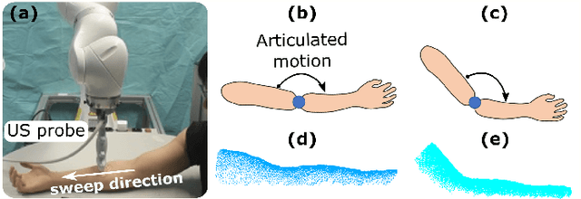 Figure 1 for Towards Autonomous Atlas-based Ultrasound Acquisitions in Presence of Articulated Motion