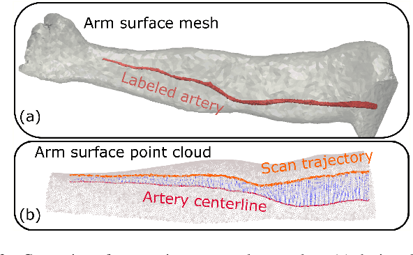 Figure 3 for Towards Autonomous Atlas-based Ultrasound Acquisitions in Presence of Articulated Motion