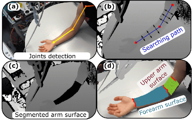 Figure 4 for Towards Autonomous Atlas-based Ultrasound Acquisitions in Presence of Articulated Motion