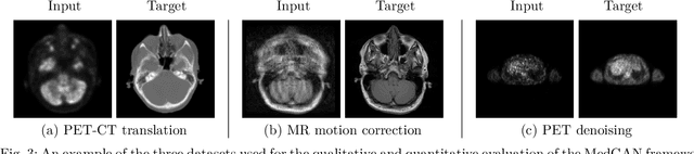 Figure 3 for MedGAN: Medical Image Translation using GANs