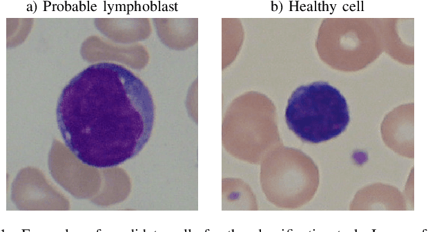Figure 1 for Acute Lymphoblastic Leukemia Detection Using Hypercomplex-Valued Convolutional Neural Networks