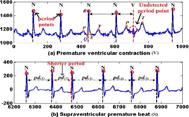 Figure 1 for Supervised Anomaly Detection in Uncertain Pseudoperiodic Data Streams