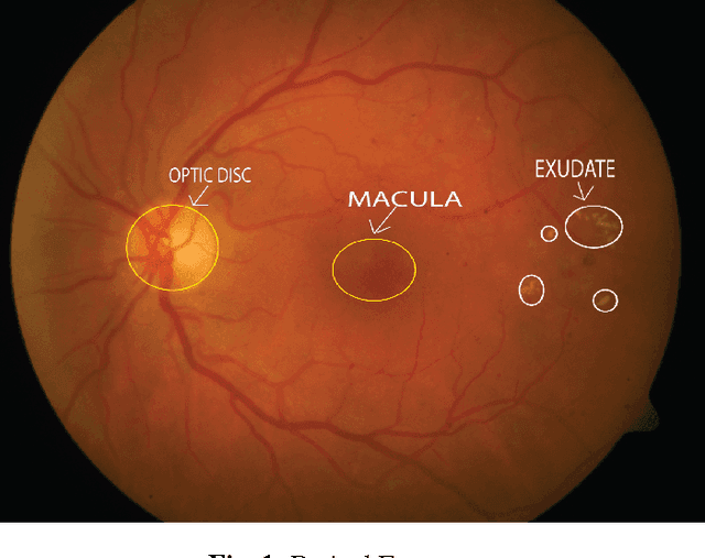 Figure 1 for A Gaussian Scale Space Approach For Exudates Detection, Classification And Severity Prediction