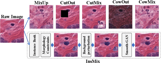 Figure 1 for InsMix: Towards Realistic Generative Data Augmentation for Nuclei Instance Segmentation