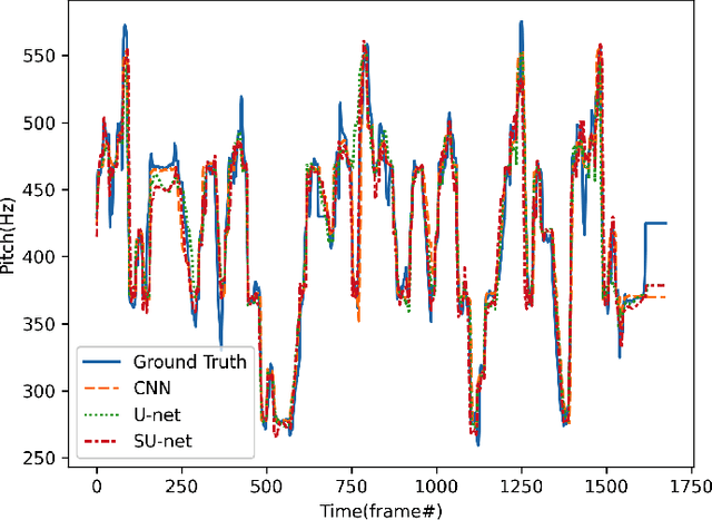 Figure 3 for SUSing: SU-net for Singing Voice Synthesis