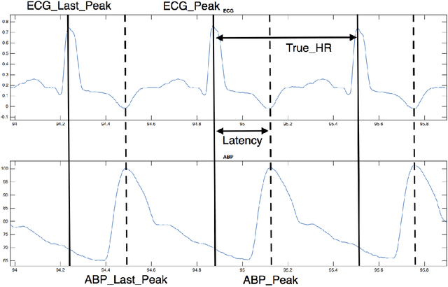 Figure 4 for Probabilistic Model-Based Approach for Heart Beat Detection