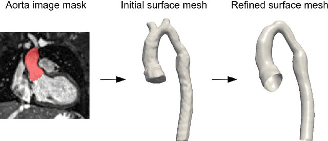Figure 1 for Deep neural networks for fast acquisition of aortic 3D pressure and velocity flow fields