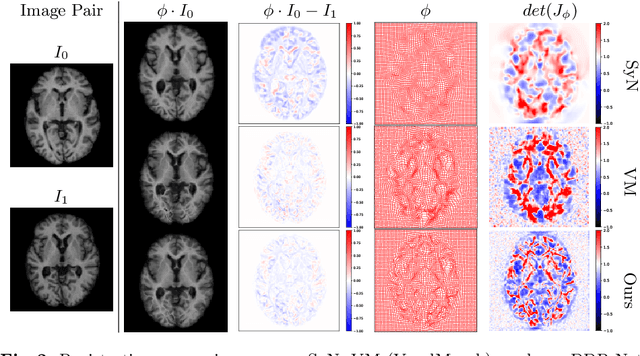 Figure 3 for DDR-Net: Dividing and Downsampling Mixed Network for Diffeomorphic Image Registration