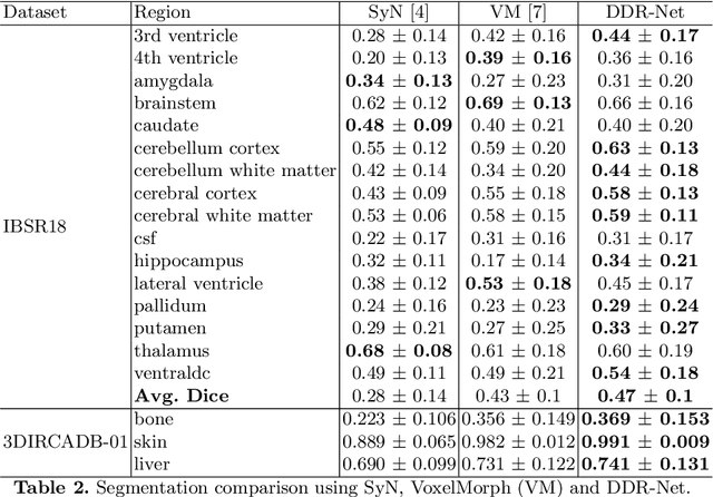 Figure 4 for DDR-Net: Dividing and Downsampling Mixed Network for Diffeomorphic Image Registration