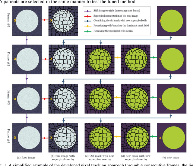 Figure 1 for Temporal extrapolation of heart wall segmentation in cardiac magnetic resonance images via pixel tracking