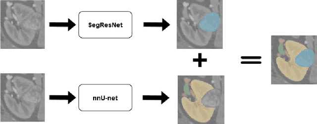 Figure 1 for Ensembled Autoencoder Regularization for Multi-Structure Segmentation for Kidney Cancer Treatment
