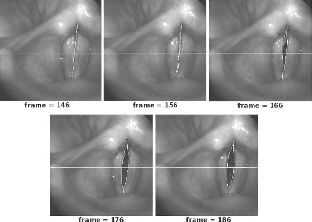 Figure 4 for On Automation and Medical Image Interpretation, With Applications for Laryngeal Imaging