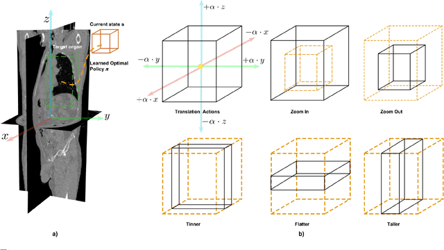 Figure 1 for Deep Reinforcement Learning for Organ Localization in CT