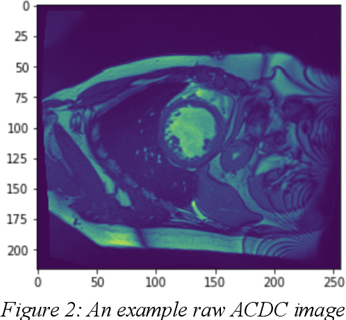 Figure 2 for Cardiac MRI Image Segmentation for Left Ventricle and Right Ventricle using Deep Learning