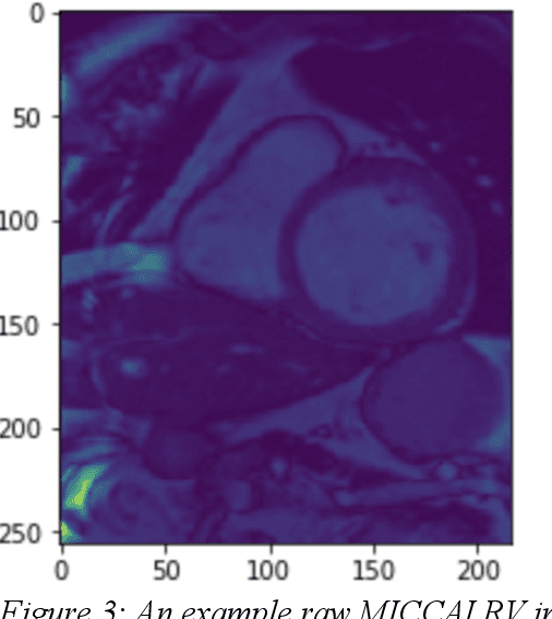 Figure 3 for Cardiac MRI Image Segmentation for Left Ventricle and Right Ventricle using Deep Learning