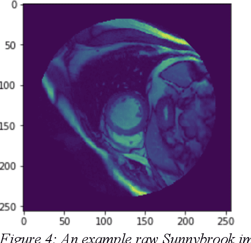 Figure 4 for Cardiac MRI Image Segmentation for Left Ventricle and Right Ventricle using Deep Learning