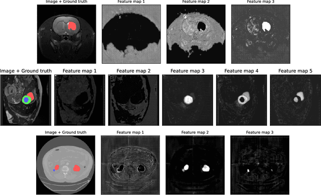 Figure 4 for Sauron U-Net: Simple automated redundancy elimination in medical image segmentation via filter pruning