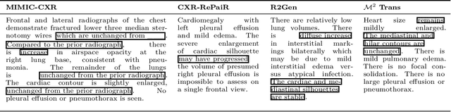 Figure 2 for Improving Radiology Report Generation Systems by Removing Hallucinated References to Non-existent Priors