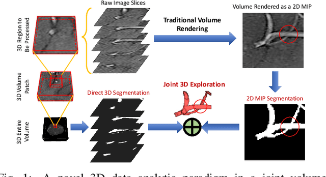 Figure 1 for VC-Net: Deep Volume-Composition Networks for Segmentation and Visualization of Highly Sparse and Noisy Image Data