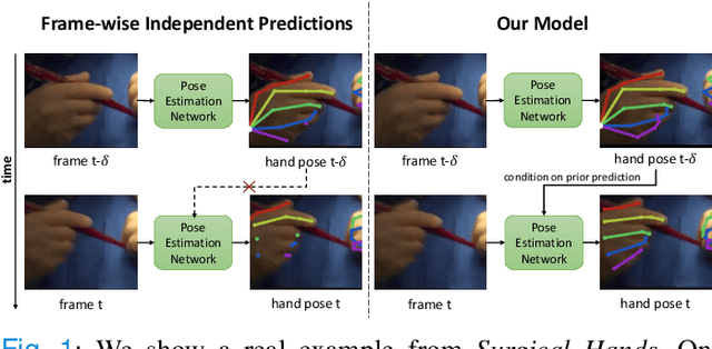 Figure 1 for Temporally Guided Articulated Hand Pose Tracking in Surgical Videos
