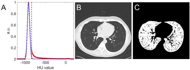 Figure 4 for Automated assessment of disease severity of COVID-19 using artificial intelligence with synthetic chest CT