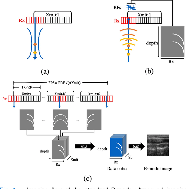 Figure 1 for Efficient B-mode Ultrasound Image Reconstruction from Sub-sampled RF Data using Deep Learning