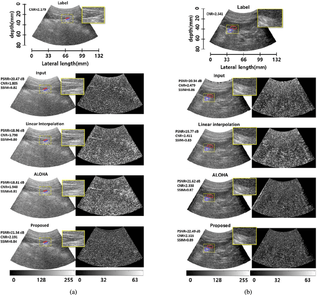 Figure 2 for Efficient B-mode Ultrasound Image Reconstruction from Sub-sampled RF Data using Deep Learning