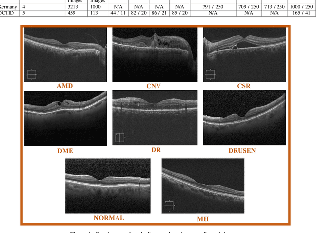 Figure 1 for ROCT-Net: A new ensemble deep convolutional model with improved spatial resolution learning for detecting common diseases from retinal OCT images